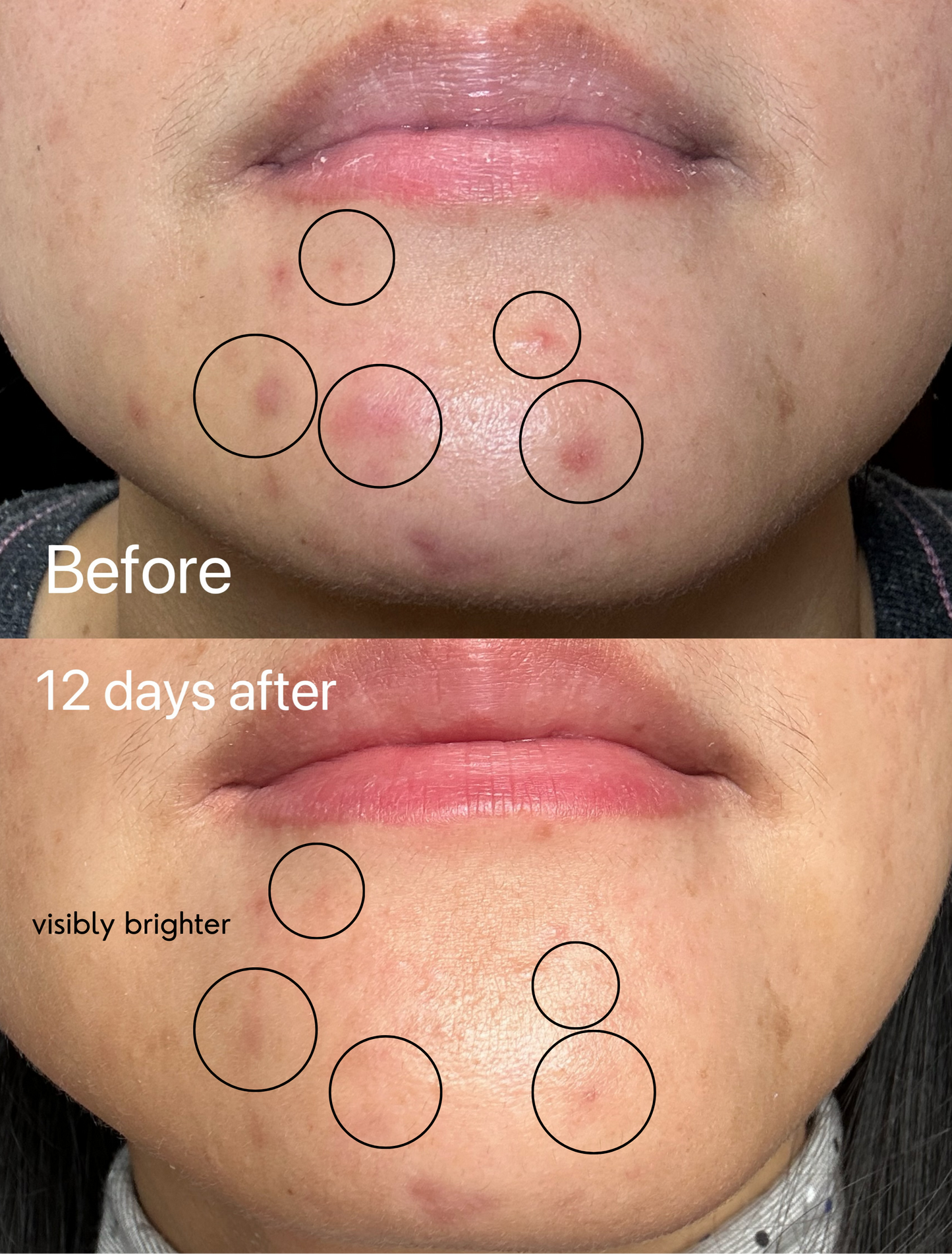 Vitamin C Brightening Capsule Serum