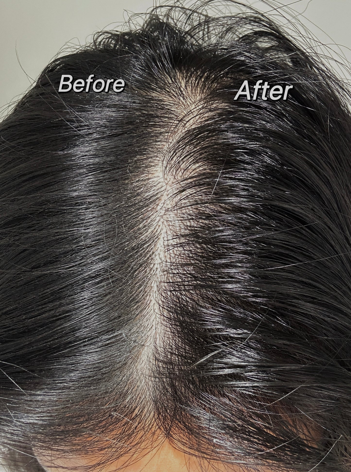 Cloud- Powder Dry Shampoo